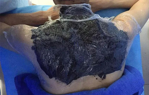 独创四联疗法专治肩周炎，7天康复！红桃视频
平阳部骨科火了！